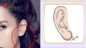 Xem tướng Tứ độc trên khuôn mặt