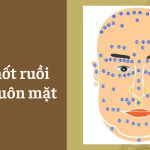 Khuôn mặt bạn có nốt ruồi không?