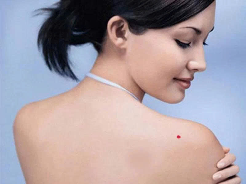 7 vị trí nốt ruồi trên vai phụ nữ tiết lộ điều gì về vận mệnh? 3 image2 202508131733198448