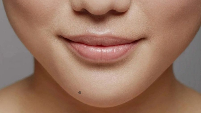 10 vị trí nốt ruồi tài lộc, phúc phần – Được xem là dấu hiệu may mắn trời ban 5 image5 202505311421363421