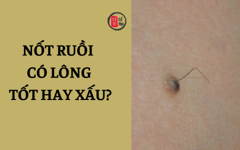 Nốt ruồi có lông là tốt hay xấu? Giải mã ý nghĩa theo quan niệm dân gian và khoa học