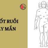 Những nốt ruồi không nên tẩy vì cực kỳ may mắn | Tử Vi Cổ Học