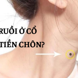 Giải mã câu nói "nốt ruồi ở cổ có lỗ tiền chôn" 3 Giải nghĩa câu nói nốt ruồi ở cổ có lỗ tiền chôn | Tử Vi Cổ Học