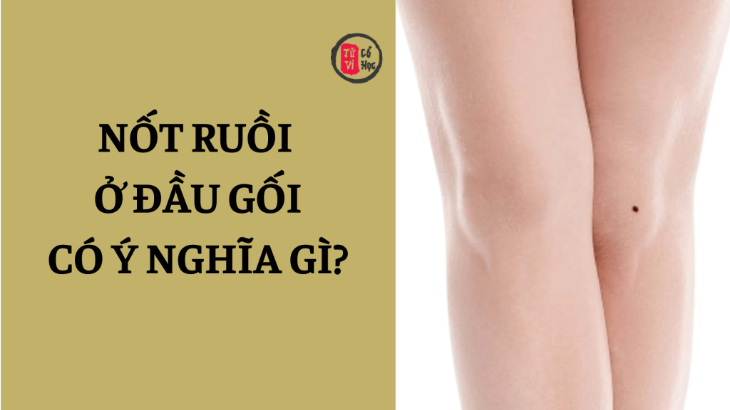 Nối ruồi ở đầu gối mang ý nghĩa gì? | Tử Vi Cổ Học