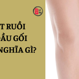Nối ruồi ở đầu gối mang ý nghĩa gì? | Tử Vi Cổ Học