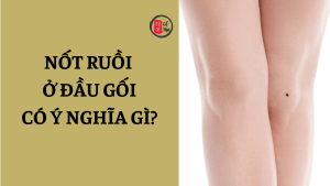 Nốt ruồi ở đầu gối có ý nghĩa gì? Người sở hữu vị trí này được dự đoán có vận mệnh ra sao?