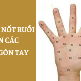 Giải mã ý nghĩa nốt ruồi trên các đốt ngón tay 4 Giải mã ý nghĩa nốt ruồi trên các đốt ngón tay | Tử Vi Cổ Học