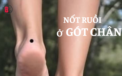 Nốt ruồi ở gót chân phải có ý nghĩa gì? 23 Nốt ruồi ở gót chân phải có ý nghĩa gì?