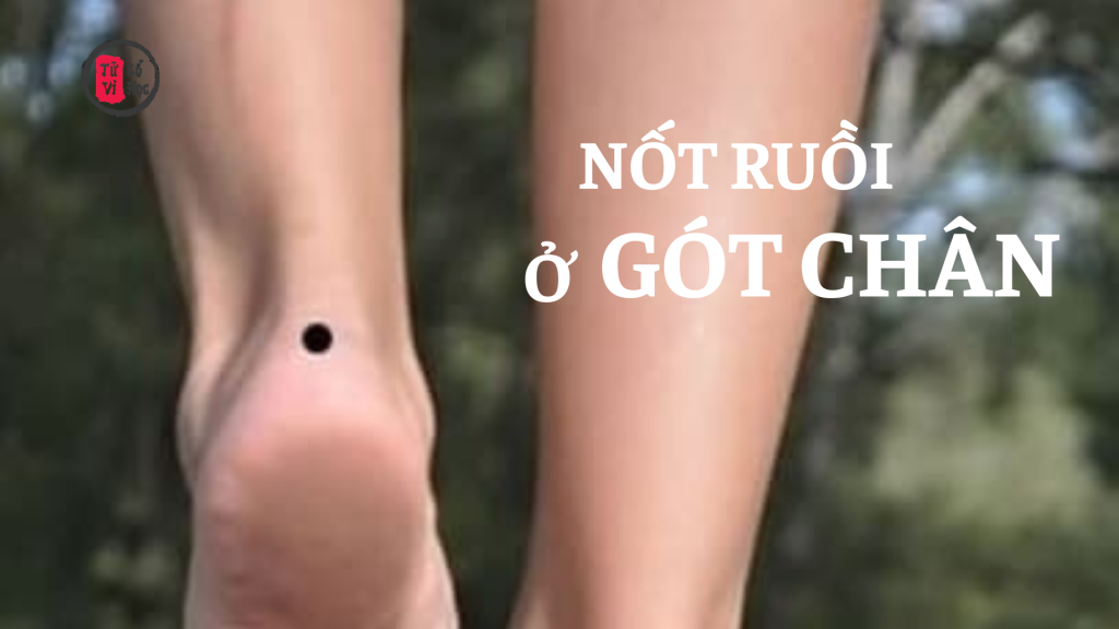 Nốt ruồi ở gót chân có ý nghĩa gì? | Tử Vi Cổ Học