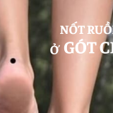 Nốt ruồi ở gót chân có ý nghĩa gì? | Tử Vi Cổ Học