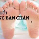Nốt ruồi ở lòng bàn chân nói lên điều gì? | Tử Vi Cổ Học
