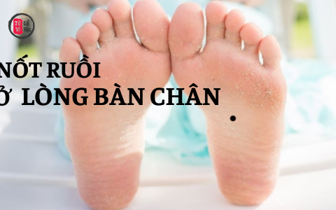 Nốt ruồi ở lòng bàn chân nói lên điều gì? 21 Nốt ruồi ở lòng bàn chân nói lên điều gì?