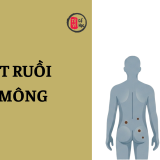 Nốt ruồi ở mông đàn ông, phụ nữ có ý nghĩa gì? | Tử Vi Cổ Học