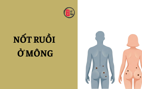 Nốt ruồi ở mông đàn ông, phụ nữ có ý nghĩa gì? 20 Nốt ruồi ở mông đàn ông, phụ nữ có ý nghĩa gì?