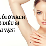 Nốt ruồi ở nách tiết lộ điều gì về tài vận?