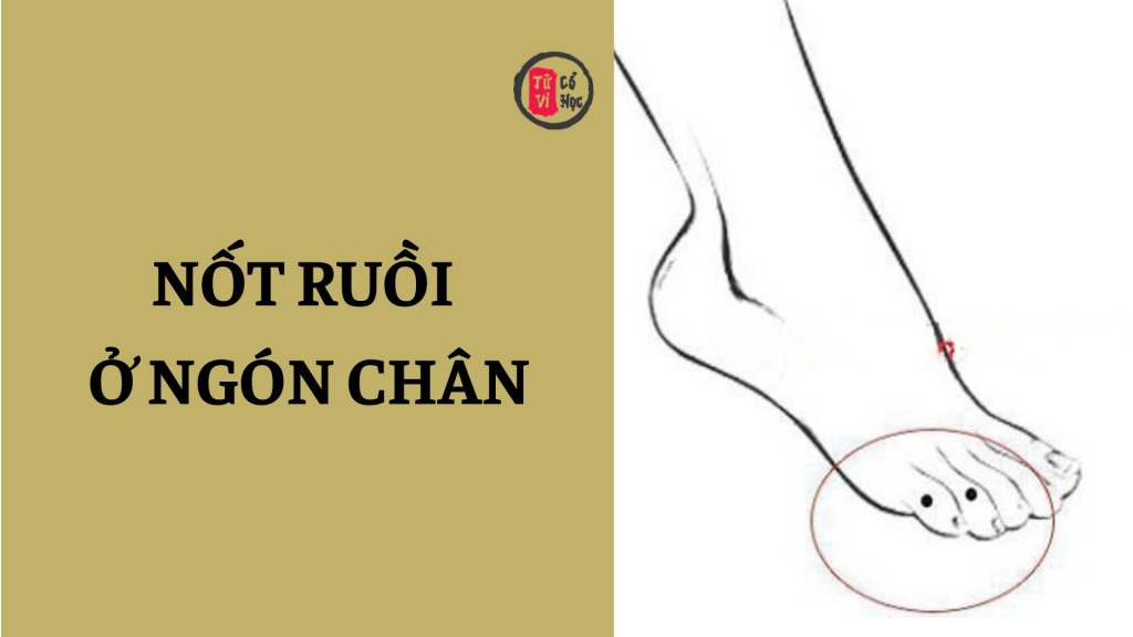 Nốt ruồi ở ngón chân mang ý nghĩa gì? | Tử Vi Cổ Học