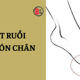 Nốt ruồi ở ngón chân mang ý nghĩa gì? | Tử Vi Cổ Học