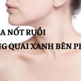 Giải nghĩa nốt ruồi ở xương quai xanh bên phải | Tử Vi Cổ Học