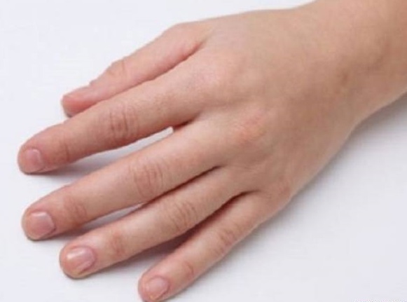 Mối liên hệ giữa ngón tay và tính cách 4 158ecb2dce844f.img