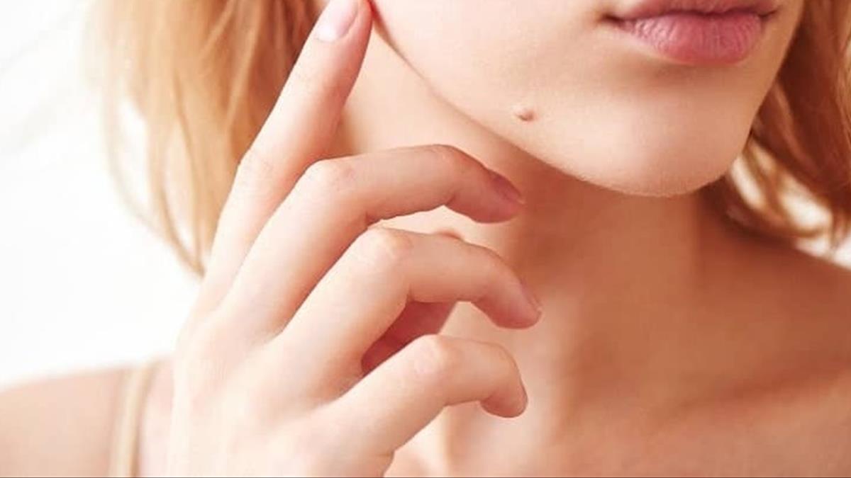 Nốt ruồi vượng phu ích tử là gì? 4 NOT RUOI DUOI CAM o vi tri nao thi phu quy con o vi tri nao thi dang lo