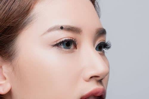 Nốt ruồi vượng phu ích tử là gì? 5 images 2 2