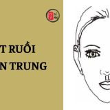 Nốt ruồi ở nhân trung có ý nghĩa gì? 7 Nốt ruồi ở nhân trung có ý nghĩa gì? | Tử Vi Cổ Học