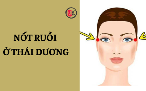 Nốt ruồi ở thái dương có nên xóa hay không? 2 Nốt ruồi ở thái dương có nên xóa hay không?