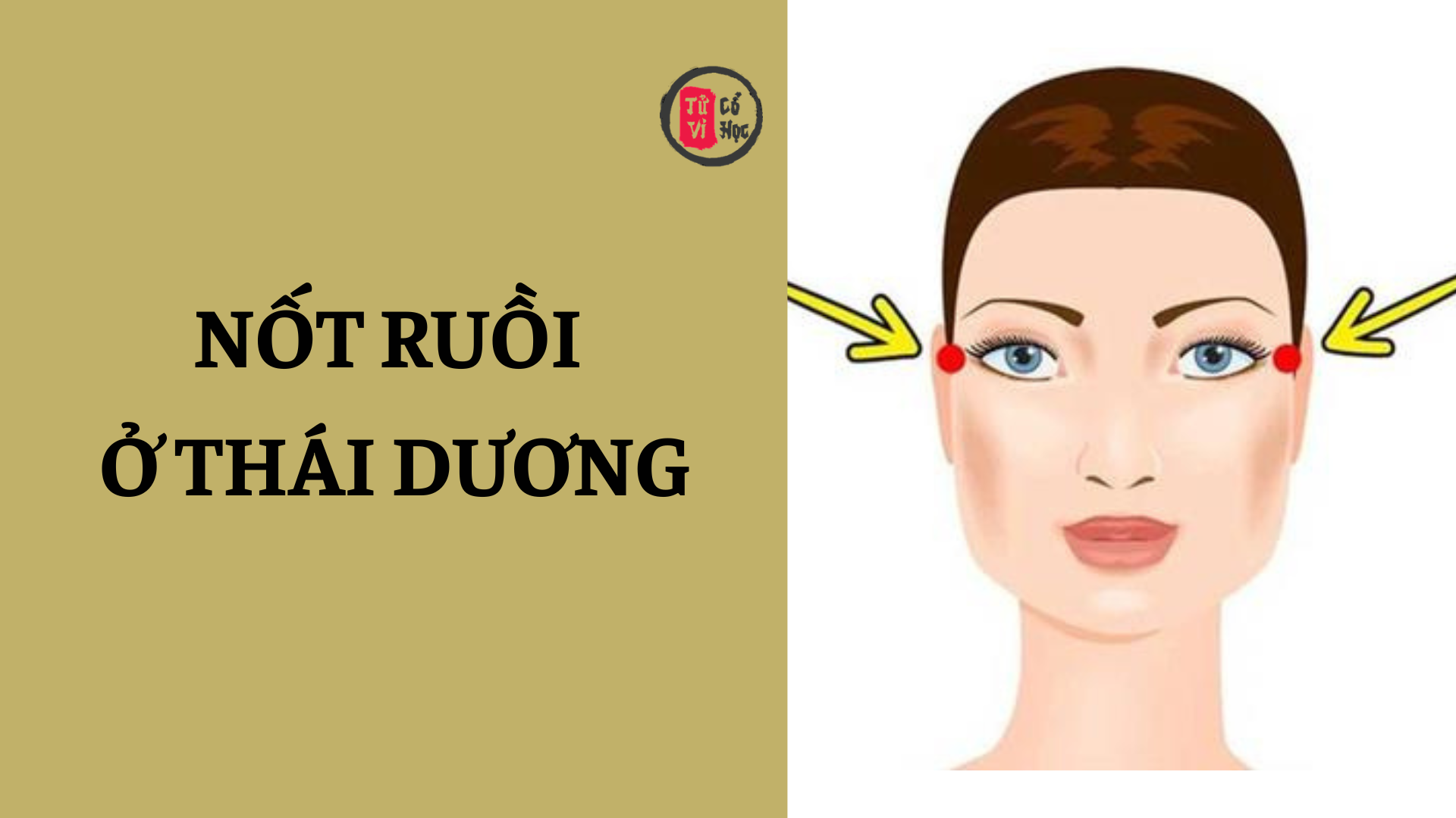 Nốt ruồi ở thái dương có nên xóa hay không? 2 Nốt ruồi ở thái dương có nên xóa hay không? | Tử Vi Cổ Học