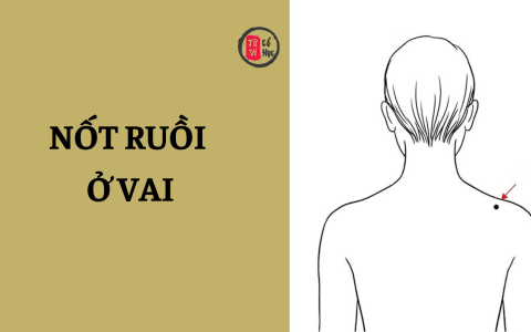 Nốt ruồi ở vai có ý nghĩa gì? 1 Nốt ruồi ở vai có ý nghĩa gì?