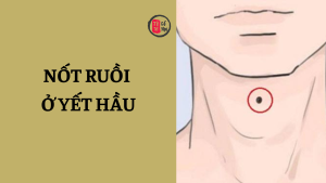 Trang chủ 37 Nốt ruồi ở yết hầu là tốt hay xấu?