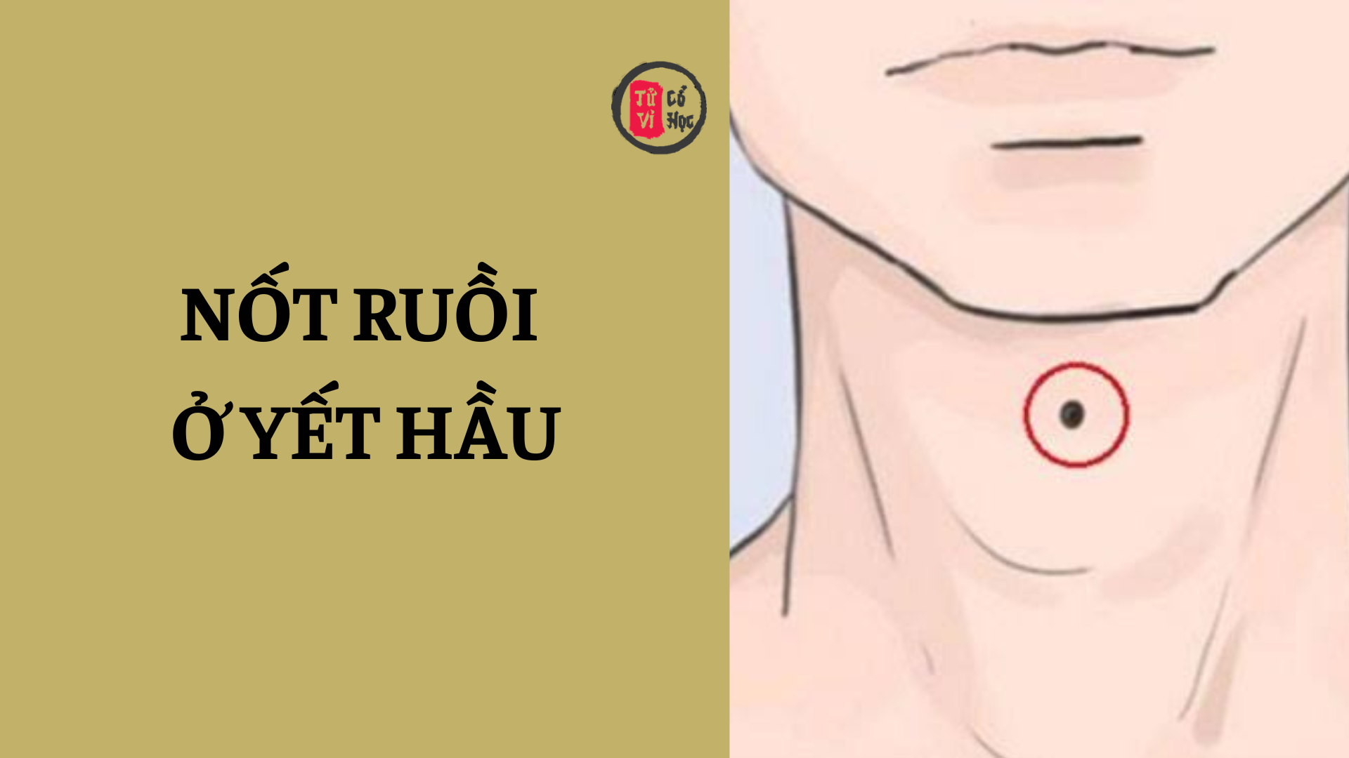 Nốt ruồi ở yết hầu là tốt hay xấu? | Tử Vi Cổ Học