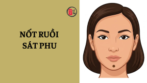 Nốt ruồi sát phu là gì?