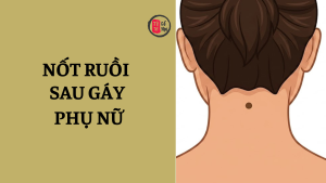 Nốt ruồi sau gáy nói lên điều gì về số phận phụ nữ?