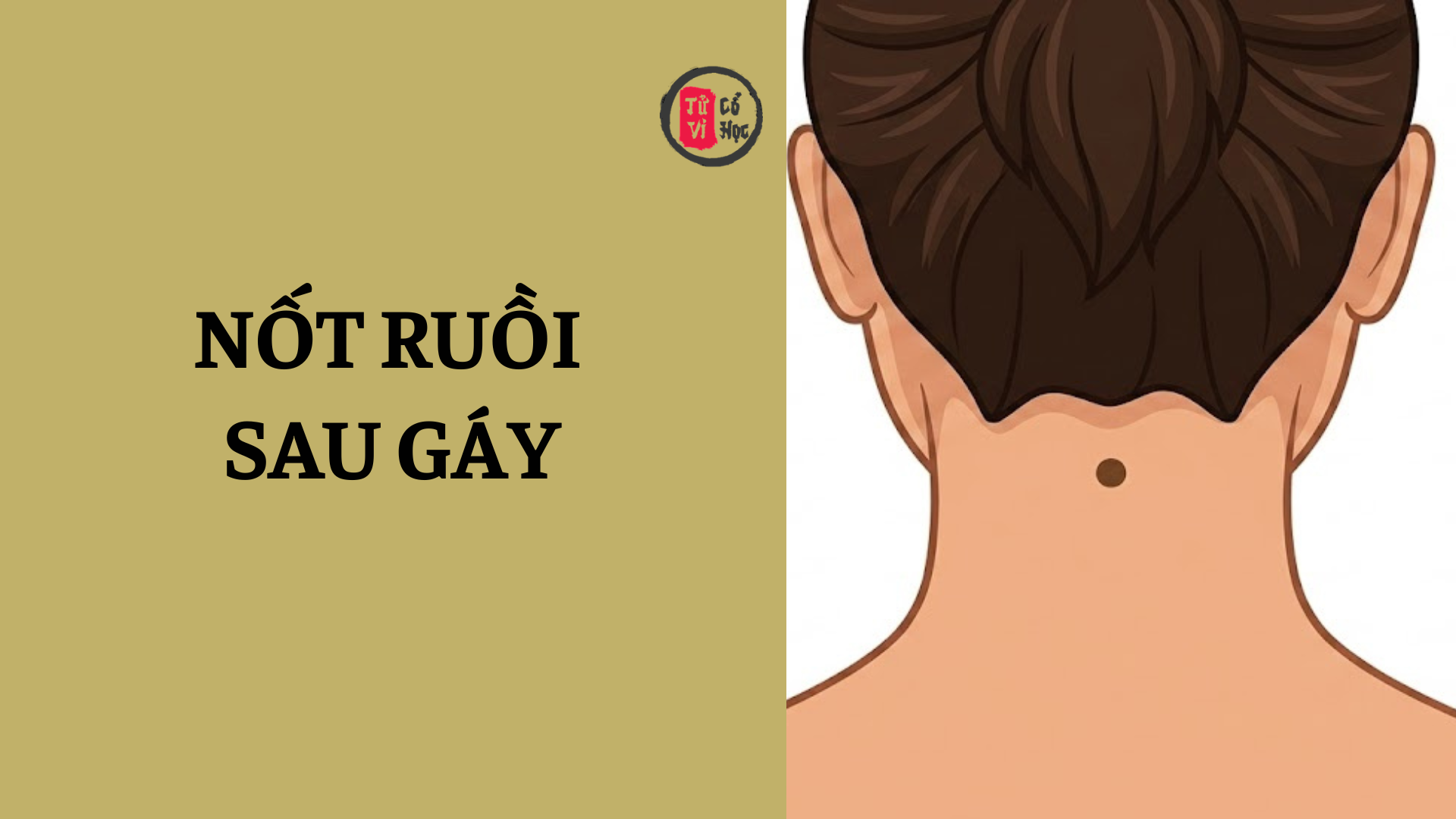Nốt ruồi sau gáy có ý nghĩa gì? | Tử Vi Cổ Học