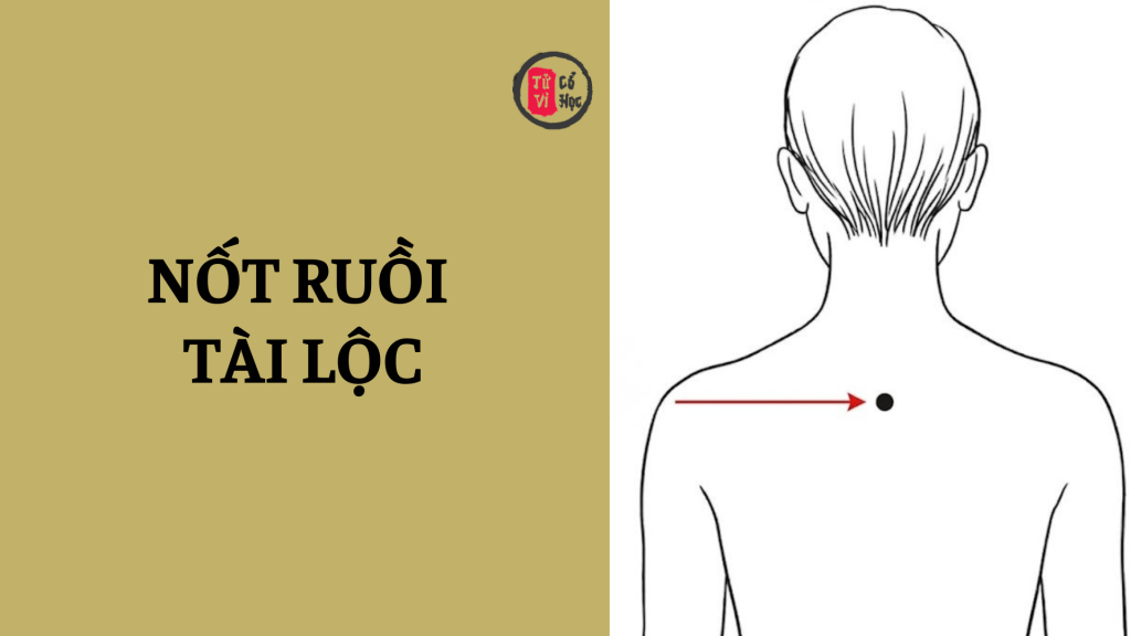 Nốt ruồi tài lộc là gì? Nốt ruồi tài lộc ở vị trí nào? | Tử Vi Cổ Học