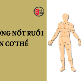 Phán đoán tính cách và vận mệnh qua vị trí nốt ruồi trên cơ thể 5 Phán đoán con người qua vị trí nốt ruồi trên cơ thể | Tử Vi Cổ Học