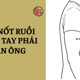 Nốt ruồi trên má có ý nghĩa gì? 7 Nốt ruồi trên má bạn gái có ý nghĩa gì? | Tử Vi Cổ Học