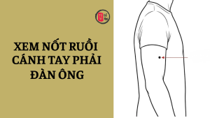 Nốt ruồi trên má có ý nghĩa gì?