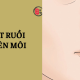 Nốt ruồi trên môi nói lên điều gì về bạn? 6 Nốt ruồi trên môi nói lên điều gì ở bạn | Tử Vi Cổ Học