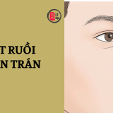 Nốt ruồi trên trán báo hiệu vận mệnh sướng khổ? 5 Nốt ruồi trên trán báo hiệu vận mệnh sướng khổ? | Tử Vi Cổ Học