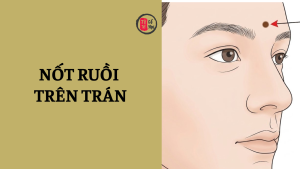 Nốt ruồi trên trán báo hiệu vận mệnh sướng khổ?