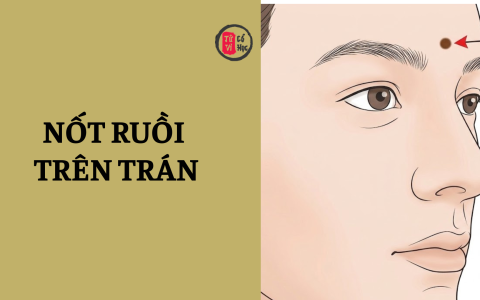 Nốt ruồi trên trán báo hiệu vận mệnh sướng khổ? 28 Nốt ruồi trên trán báo hiệu vận mệnh sướng khổ?