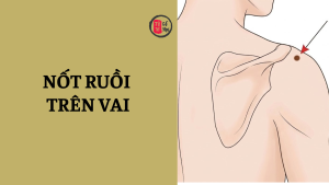 Nốt ruồi trên vai đàn ông và phụ nữ có ý nghĩa gì?