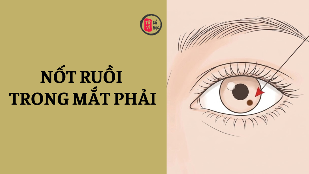 Nốt ruồi trong mắt phải có ý nghĩa gì? | Tử Vi Cổ Học