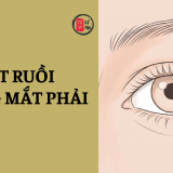 Nốt ruồi trong mắt phải có ý nghĩa gì? 4 Nốt ruồi trong mắt phải có ý nghĩa gì? | Tử Vi Cổ Học