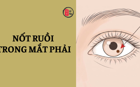 Nốt ruồi trong mắt phải có ý nghĩa gì? 25 Nốt ruồi trong mắt phải có ý nghĩa gì?
