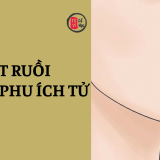 Nốt ruồi vượng phu ích tử là gì? 3 Nốt ruồi vượng phu ích tử có nghĩa là gì? | Tử Vi Cổ Học