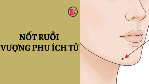 Nốt ruồi vượng phu ích tử là gì?