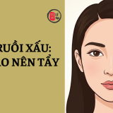 Nốt ruồi xấu là gì? Cách nhận biết và có nên tẩy nốt ruồi xấu? 6 Nốt ruồi xấu là gì? Cách nhận biết và có nên tẩy nốt ruồi xấu? | Tử Vi Cổ Học