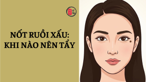 Trang chủ 41 Nốt ruồi xấu là gì? Cách nhận biết và có nên tẩy nốt ruồi xấu?
